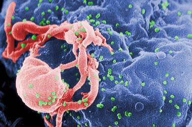 HIV AIDS Course